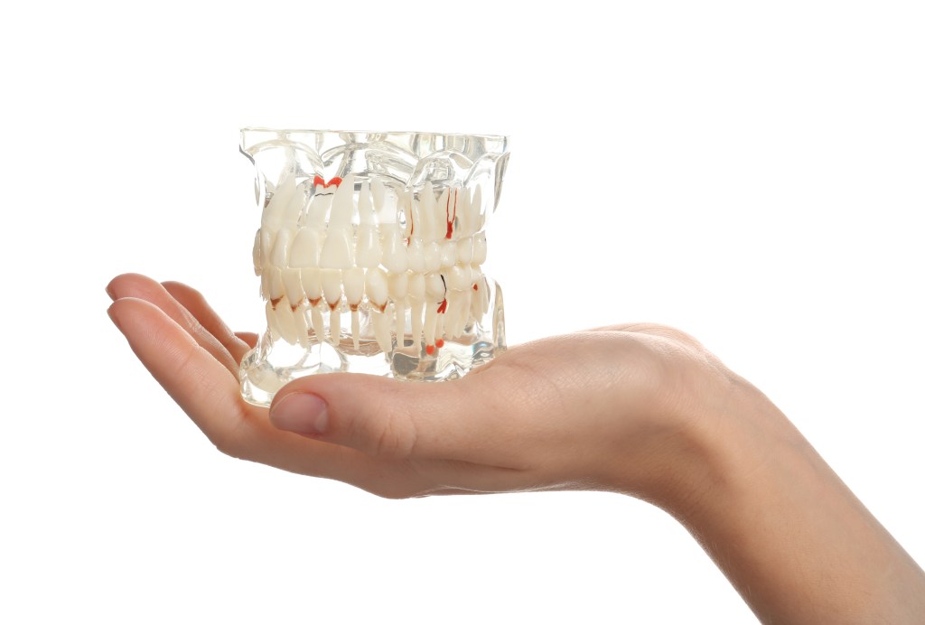 Are Full Arch Dental Implants Only for Denture&nbsp;Wearers?